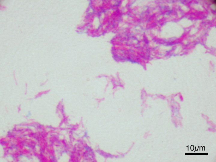 Microscopic image of the BCG Japan strain; an illustration of the vaccine organism, not a photograph from 1921.