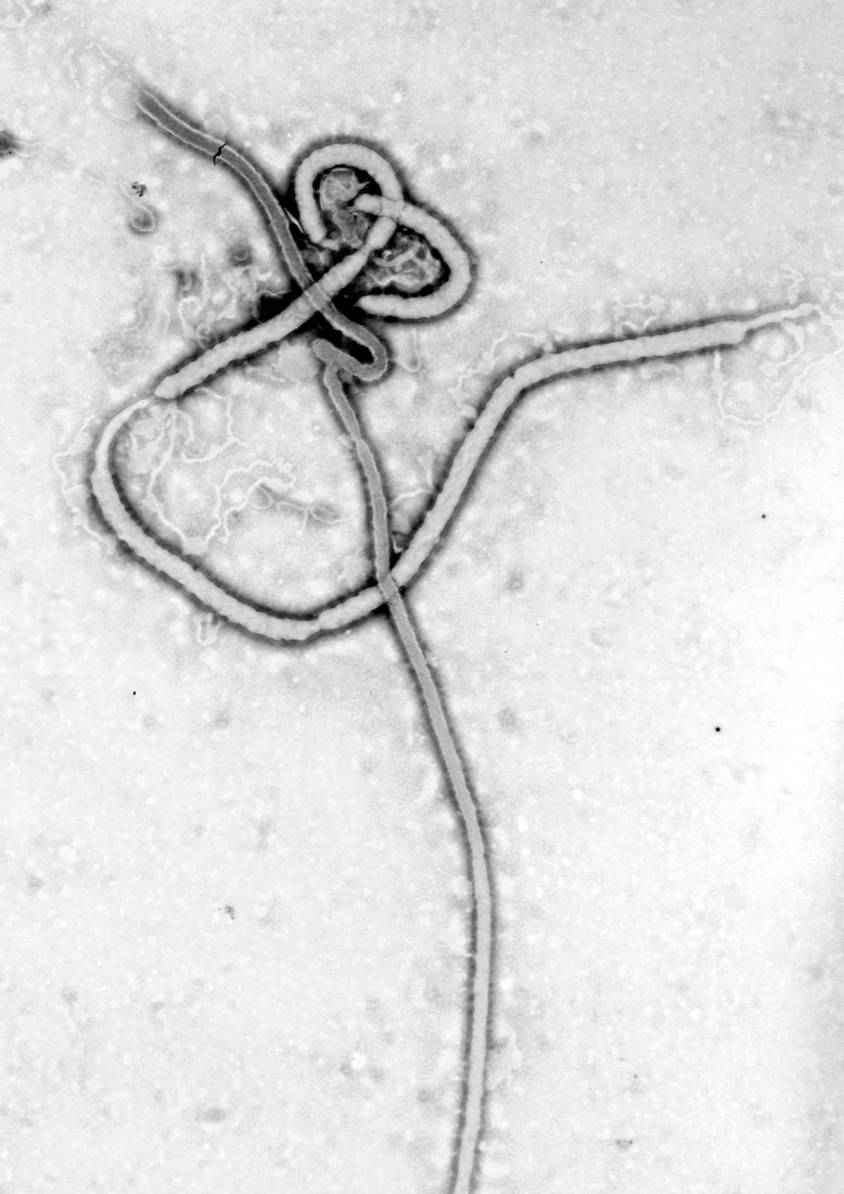 An electron micrograph of Ebola virus; it depicts the pathogen, not a vaccine product.
